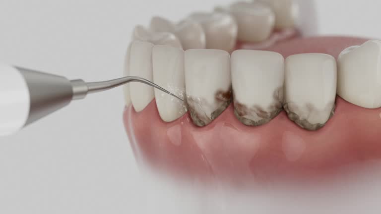 Reliable Dental contractor in Binghamton University, NY by Dentist Open Now